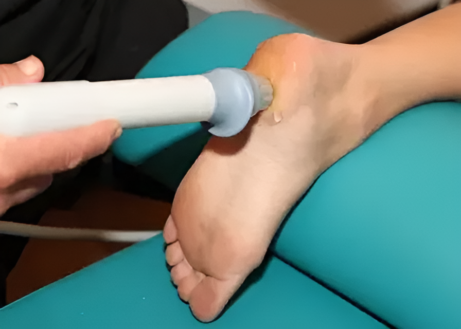 Stötvågsbehandling med modern utrustning